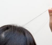 “Estallido del cuero cabelludo”, el peligroso reto viral en TikTok